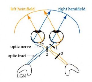 Right Visual Field